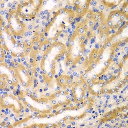 Invitrogen BCAS3 Polyclonal Antibody 100 &mu;L | Buy Online | Invitrogen&trade; | Fisher Scientific