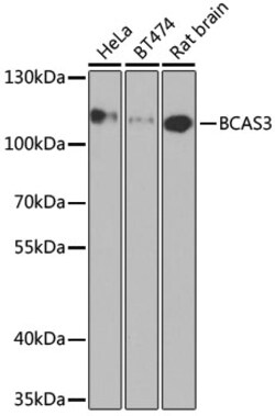 Invitrogen BCAS3 Polyclonal Antibody 100 &mu;L | Buy Online | Invitrogen&trade; | Fisher Scientific