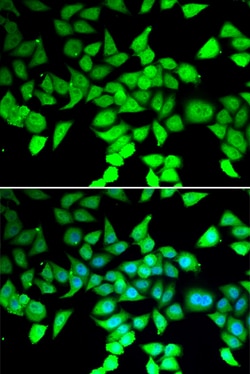 Invitrogen HDAC7 Polyclonal Antibody 100 &mu;L; Unconjugated:Antibodies,