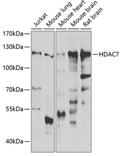 Invitrogen HDAC7 Polyclonal Antibody 100 &mu;L; Unconjugated:Antibodies,