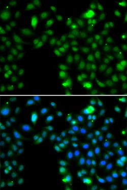 Invitrogen ING5 Polyclonal Antibody 100 &mu;L; Unconjugated:Antibodies,