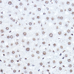 Invitrogen SETD5 Polyclonal Antibody 100 &mu;L; Unconjugated:Antibodies,