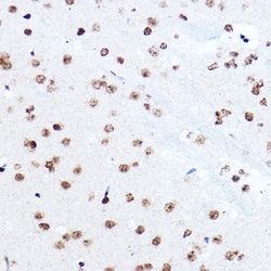 Invitrogen SETD5 Polyclonal Antibody 100 &mu;L; Unconjugated:Antibodies,