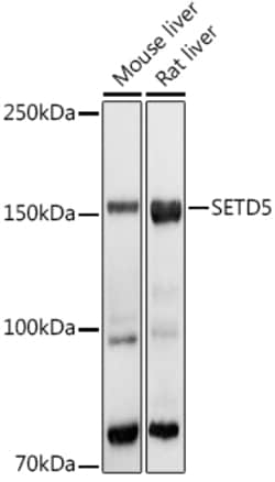 Invitrogen SETD5 Polyclonal Antibody 100 &mu;L; Unconjugated:Antibodies,