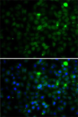 Invitrogen SMYD4 Polyclonal Antibody 100 &mu;L; Unconjugated:Antibodies,