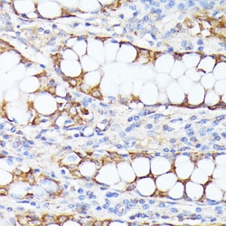 Invitrogen SMYD4 Polyclonal Antibody 100 &mu;L; Unconjugated:Antibodies,