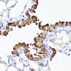 Invitrogen SMYD4 Polyclonal Antibody 100 &mu;L; Unconjugated:Antibodies,