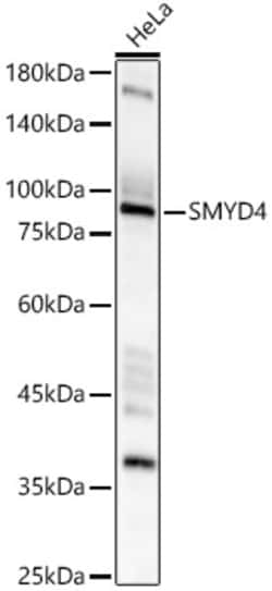 Invitrogen SMYD4 Polyclonal Antibody 100 &mu;L; Unconjugated:Antibodies,