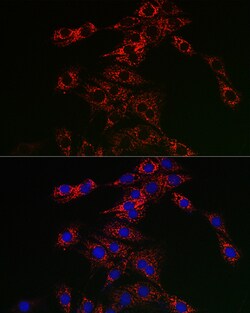Invitrogen TFEB Polyclonal Antibody 100 &mu;L; Unconjugated:Antibodies,