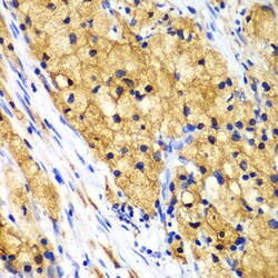 Invitrogen CAPG Polyclonal Antibody 100 &mu;L; Unconjugated:Antibodies,