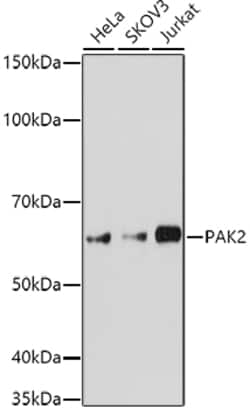 PAK2 Polyclonal Antibody:Antibodies, Polyclonal