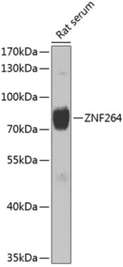 Invitrogen ZNF264 Polyclonal Antibody 100 &mu;L; Unconjugated:Antibodies,