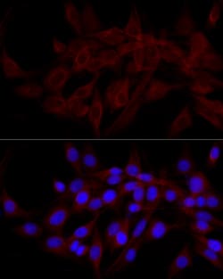 Invitrogen CALCOCO2 Polyclonal Antibody 100 &mu;L; Unconjugated:Antibodies,