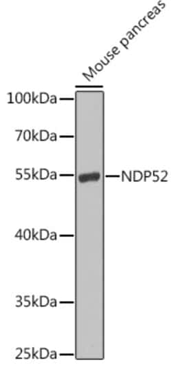 Invitrogen CALCOCO2 Polyclonal Antibody 100 &mu;L; Unconjugated:Antibodies,