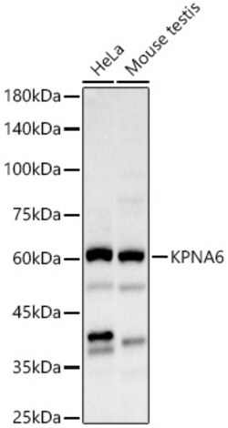 Invitrogen KPNA6 Polyclonal Antibody 100 &mu;L; Unconjugated:Antibodies,