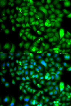 Invitrogen CSRP2BP Polyclonal Antibody 100 &mu;L; Unconjugated:Antibodies,