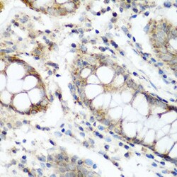 Invitrogen NAT15 Polyclonal Antibody 100 &mu;L; Unconjugated:Antibodies,