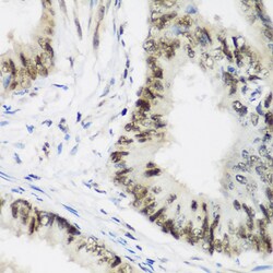 Invitrogen AEBP2 Polyclonal Antibody 100 &mu;L; Unconjugated:Antibodies,