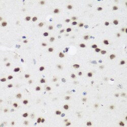 Invitrogen AEBP2 Polyclonal Antibody 100 &mu;L; Unconjugated:Antibodies,