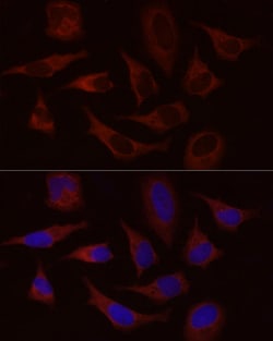 Invitrogen STIM1 Polyclonal Antibody 100 &mu;L; Unconjugated:Antibodies,