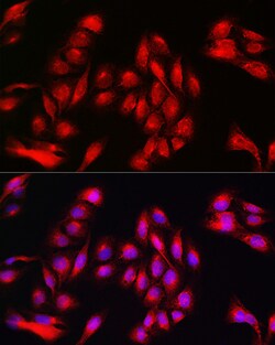 Invitrogen Annexin A11 Polyclonal Antibody 100 &mu;L; Unconjugated:Antibodies,