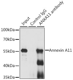 Invitrogen Annexin A11 Polyclonal Antibody 100 &mu;L; Unconjugated:Antibodies,