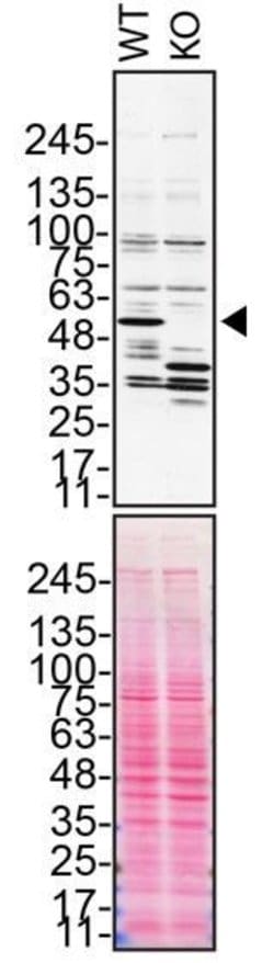 Invitrogen Annexin A11 Polyclonal Antibody 100 &mu;L; Unconjugated:Antibodies,