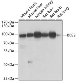 Invitrogen BBS2 Polyclonal Antibody 100 &mu;L; Unconjugated:Antibodies,