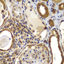 Invitrogen NME2 Polyclonal Antibody 100 &mu;L; Unconjugated:Antibodies,