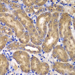 Invitrogen NME2 Polyclonal Antibody 100 &mu;L; Unconjugated:Antibodies,