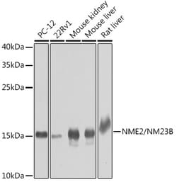 Invitrogen NME2 Polyclonal Antibody 100 &mu;L; Unconjugated:Antibodies,