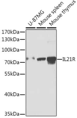 Invitrogen IL21R Polyclonal Antibody 100 &mu;L; Unconjugated:Antibodies,