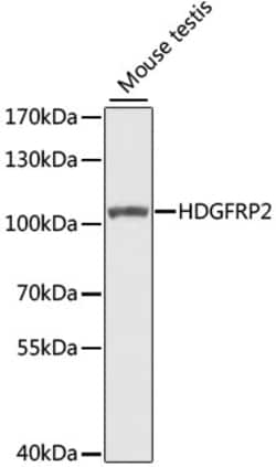 Invitrogen HDGFRP2 Polyclonal Antibody 100 &mu;L; Unconjugated:Antibodies,