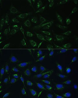 Invitrogen HCCS Polyclonal Antibody 100 &mu;L; Unconjugated:Antibodies,