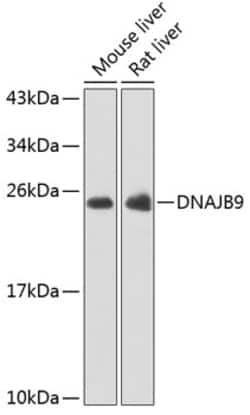 Invitrogen DNAJB9 Polyclonal Antibody 100 &mu;L; Unconjugated:Antibodies,