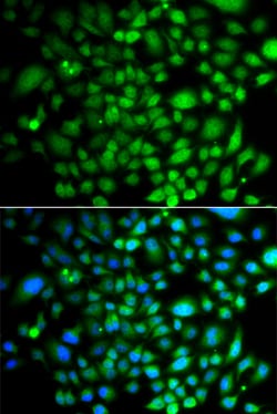 Invitrogen BRK Polyclonal Antibody 100 &mu;L; Unconjugated:Antibodies,