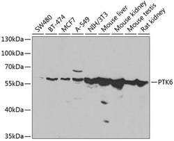 Invitrogen BRK Polyclonal Antibody 100 &mu;L; Unconjugated:Antibodies,