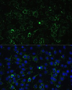 Invitrogen ALDH1A2 Polyclonal Antibody 100 &mu;L; Unconjugated:Antibodies,