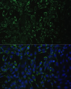 Invitrogen ALDH1A2 Polyclonal Antibody 100 &mu;L; Unconjugated:Antibodies,