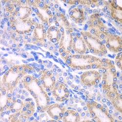 Invitrogen ALDH1A2 Polyclonal Antibody 100 &mu;L; Unconjugated:Antibodies,