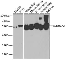 Invitrogen ALDH1A2 Polyclonal Antibody 100 &mu;L; Unconjugated:Antibodies,