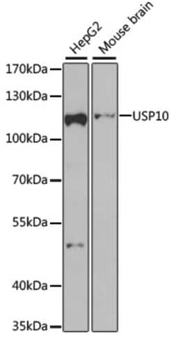 Invitrogen USP10 Polyclonal Antibody 100 &mu;L; Unconjugated:Antibodies,