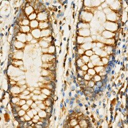 Invitrogen eIF4G Polyclonal Antibody 100 &mu;L; Unconjugated:Antibodies,