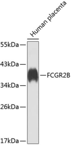 Invitrogen CD32b Polyclonal Antibody 100 &mu;L; Unconjugated:Antibodies,