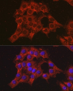 Invitrogen CCL3 Polyclonal Antibody 100 &mu;L; Unconjugated:Antibodies,