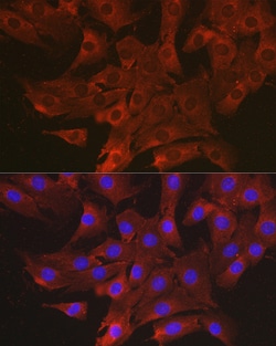Invitrogen CCL3 Polyclonal Antibody 100 &mu;L; Unconjugated:Antibodies,