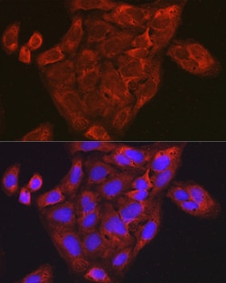 Invitrogen CCL3 Polyclonal Antibody 100 &mu;L; Unconjugated:Antibodies,