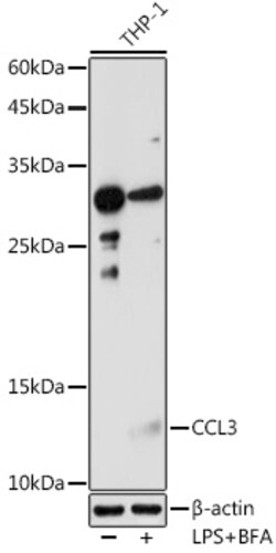 Invitrogen CCL3 Polyclonal Antibody 100 &mu;L; Unconjugated:Antibodies,
