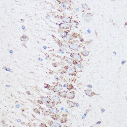 Invitrogen SIRT4 Polyclonal Antibody 100 &mu;L; Unconjugated:Antibodies,