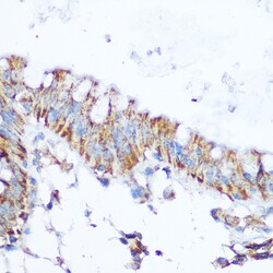 Invitrogen SIRT4 Polyclonal Antibody 100 &mu;L; Unconjugated:Antibodies,